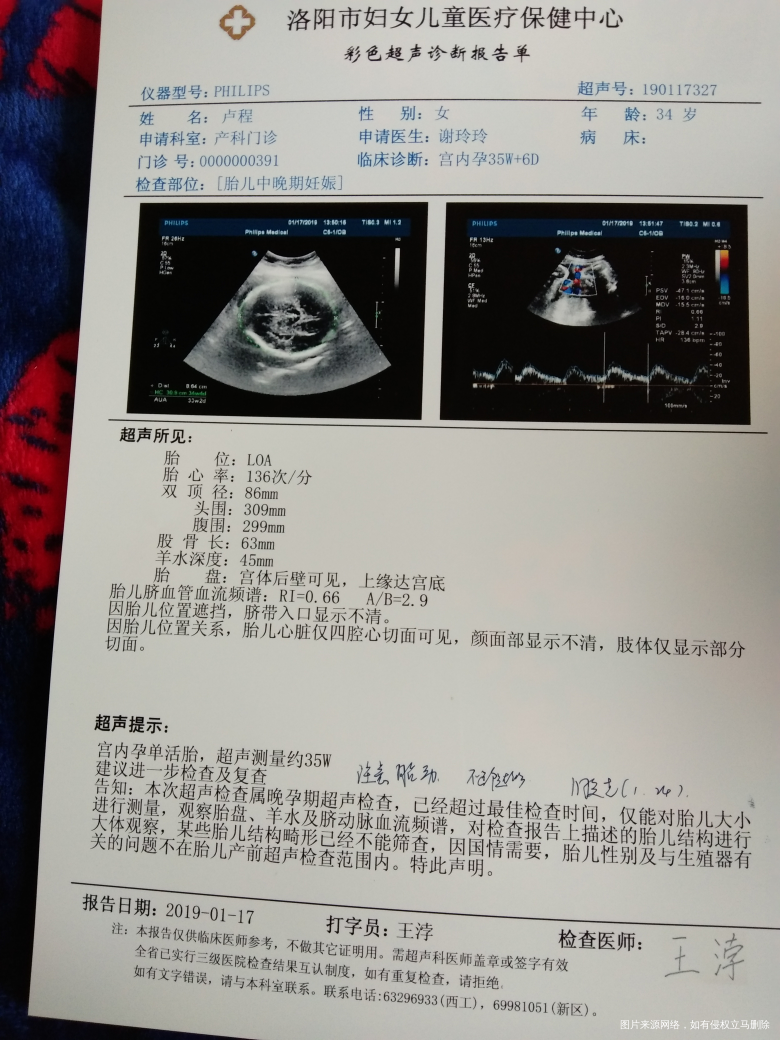 请医生帮帮我,我该怎么办,宝宝有事没。