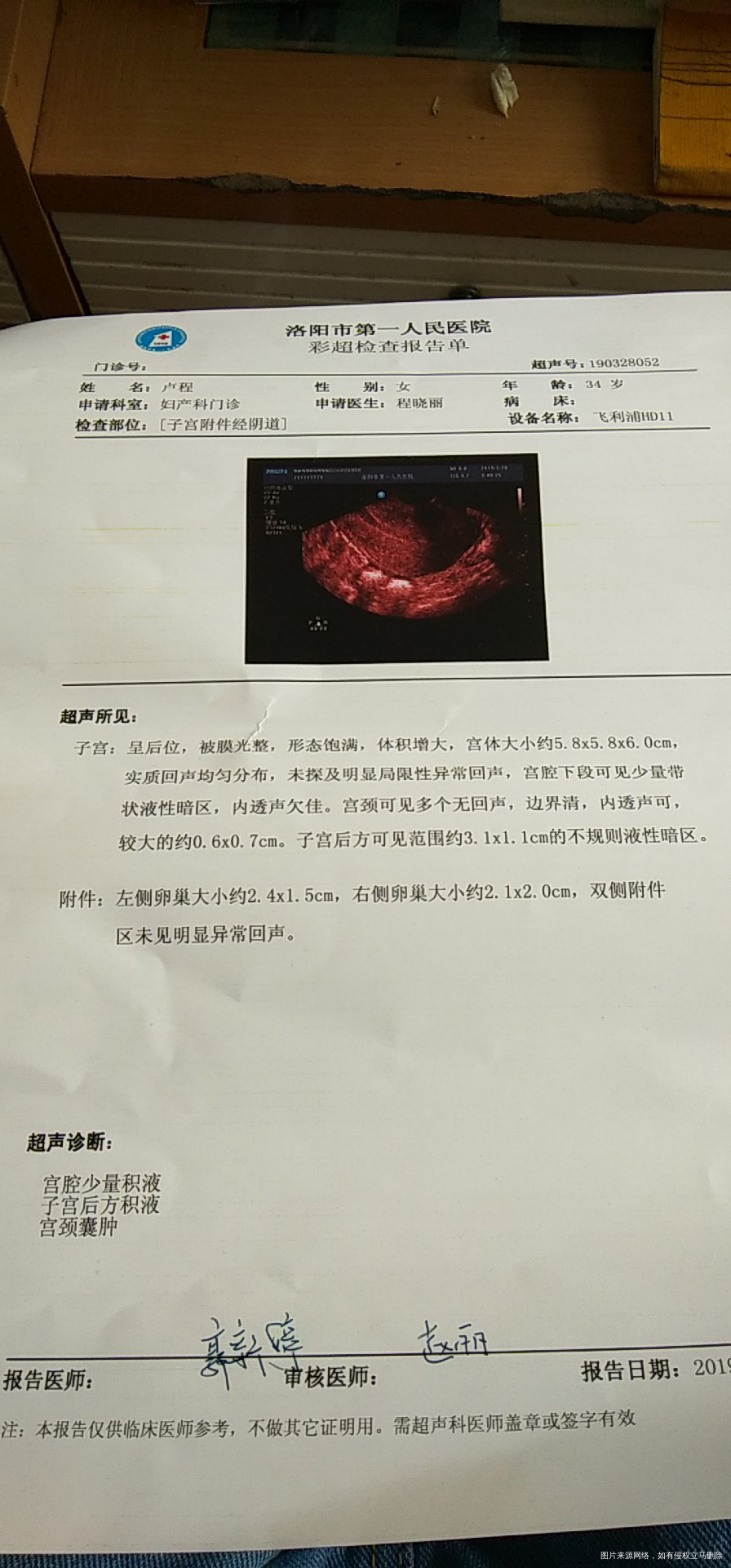 产后复查,请医生帮忙看下。