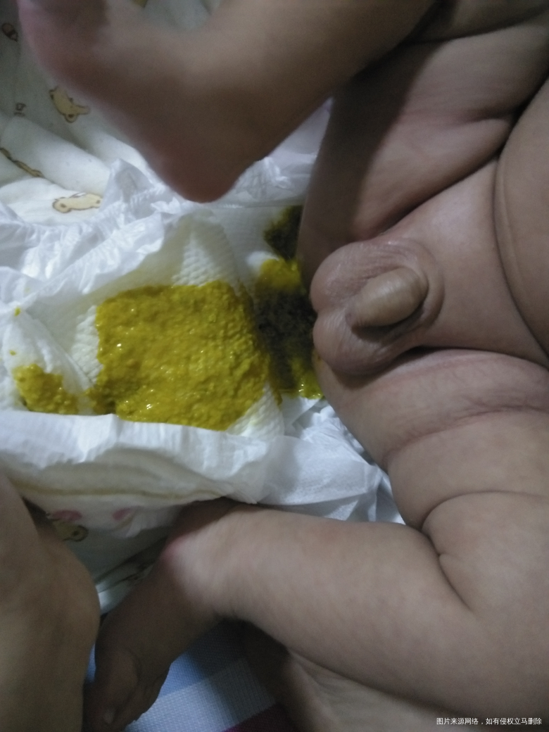 急急急!!!求医生们看看俺家孩子怎么回事,俺家孩子73天