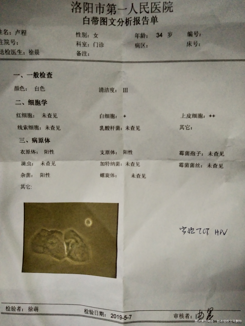 急急急,请医生,咨询个问题,哺乳期。