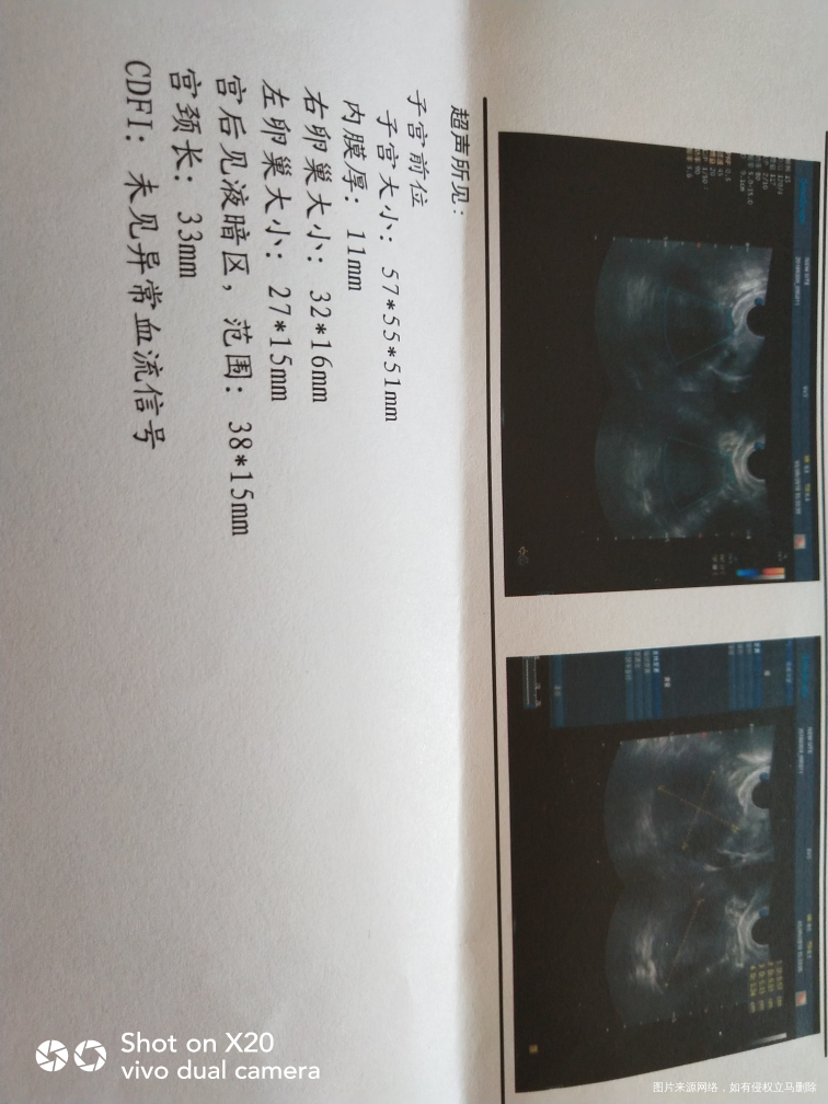 是怀孕了吗?还是姨妈快来了?