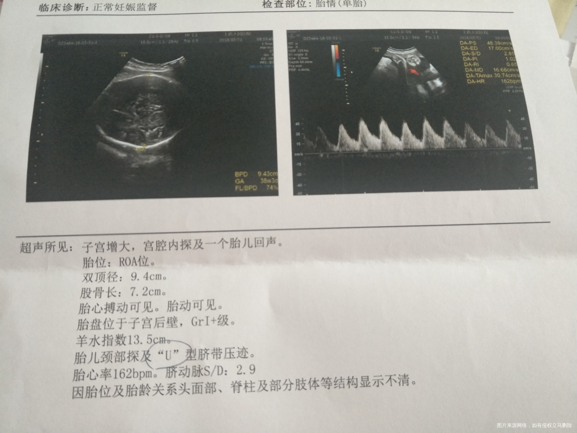 医生看一下下面单子各方面情况