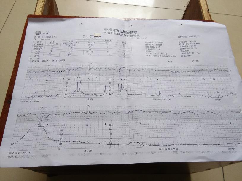 39周十1刚做的胎心监护医生说不好下午重做一次