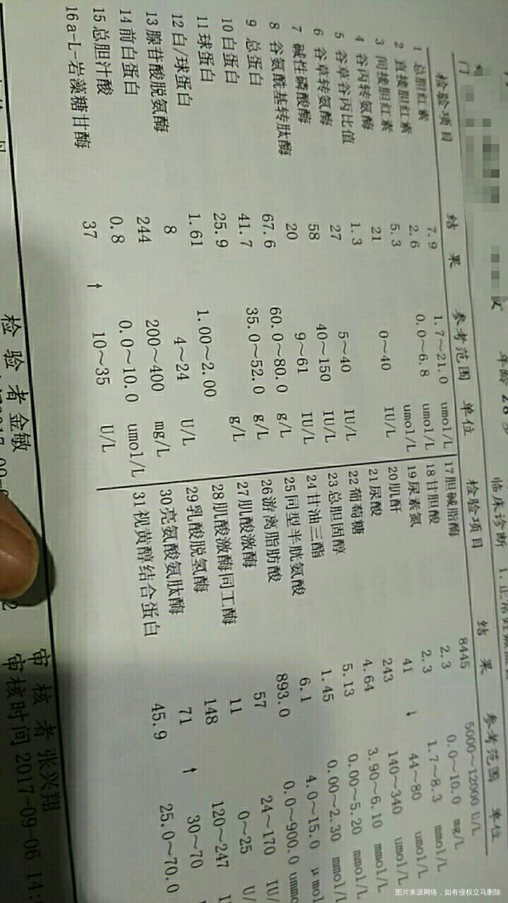 有几项有剪头,有人能看懂吗?