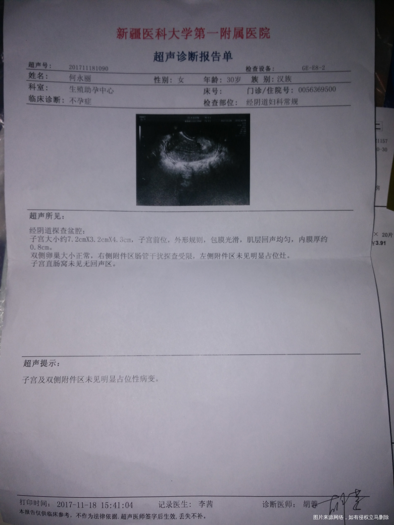 卵巢早衰,输卵管有积液救大神