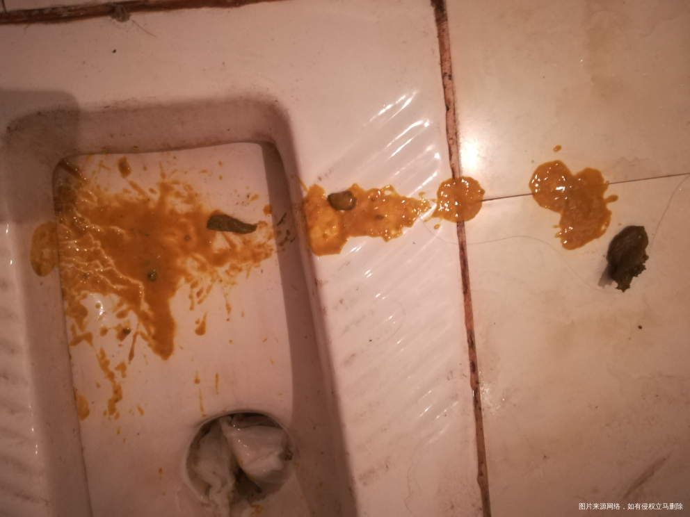 宝宝的便便真是一言难尽呀!以前用的尿不湿没亲眼看见,今天亲眼看到了她排便的过程,...