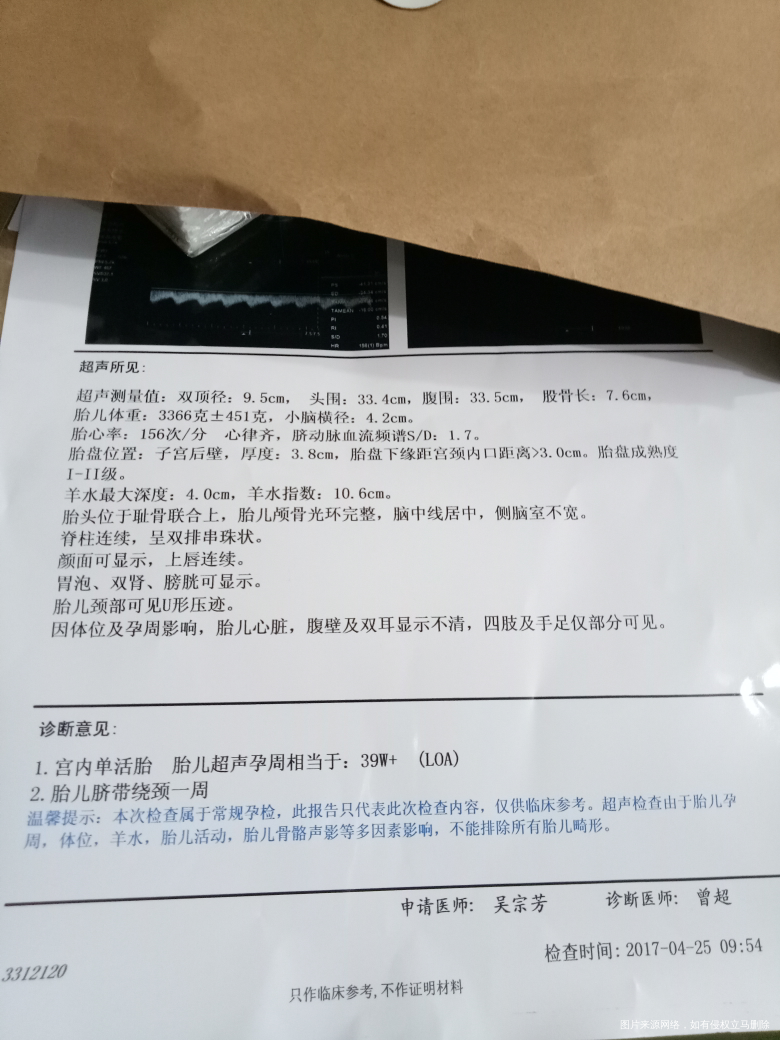 【我的生产经验】说一说我超快顺产7.2斤男宝的经历