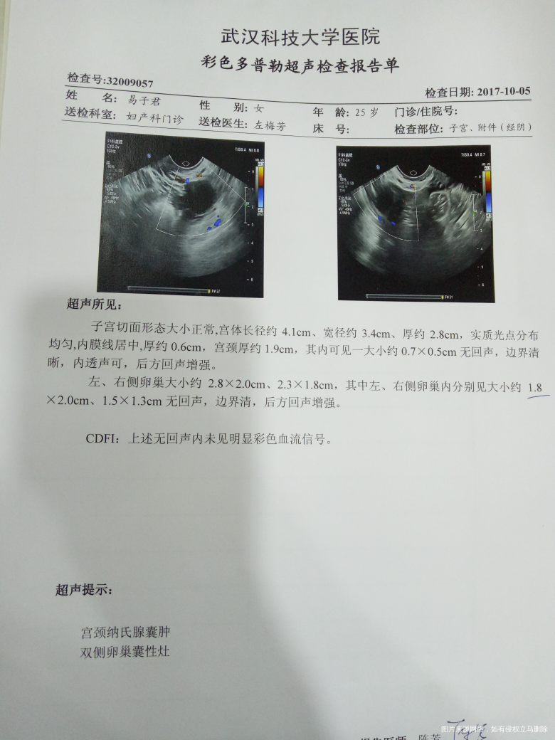 有哪位医生可以帮我解答一下是什么原因