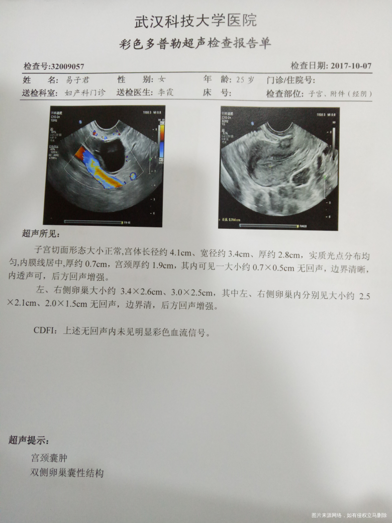 有哪位医生可以帮我解答一下是什么原因