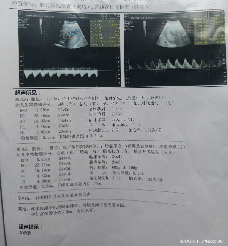 请问医生帮我看看这个b超结果正常吗