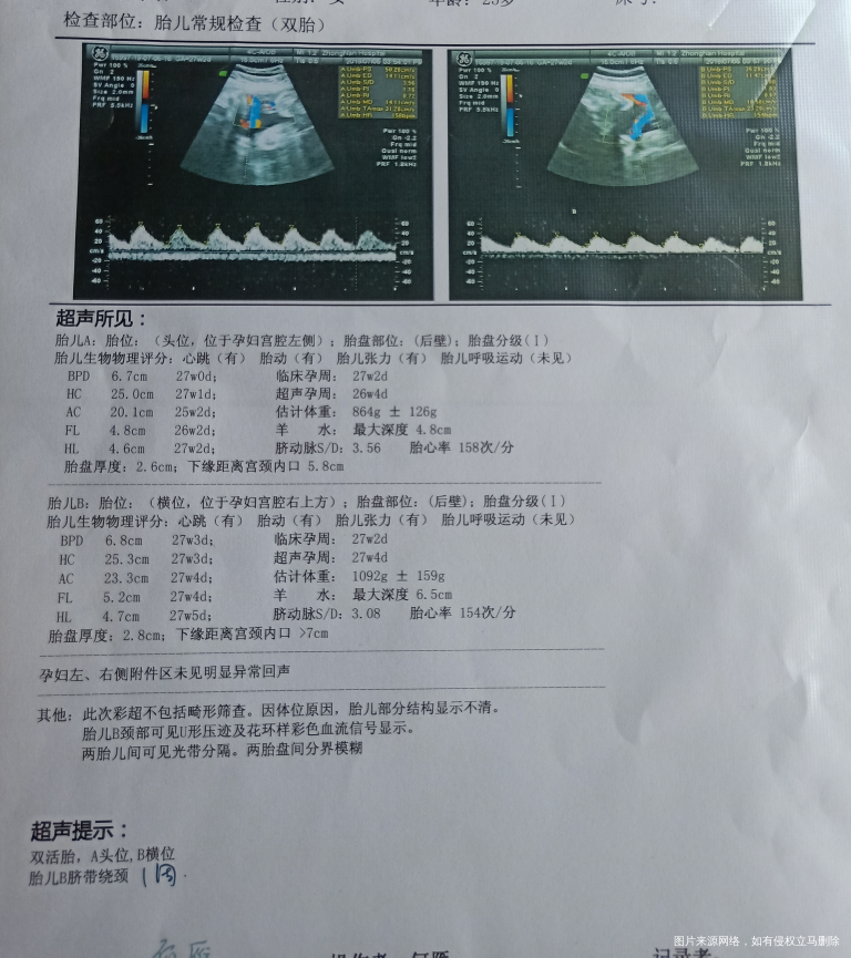 双胎孕27+5天,可以喝阿司匹林溶肠片吗