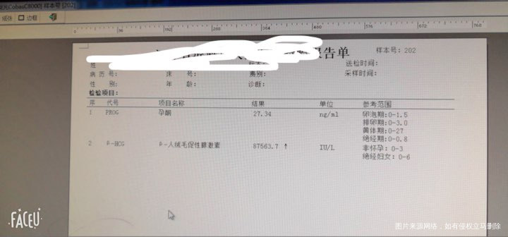 孕9周hcg下降正常吗?