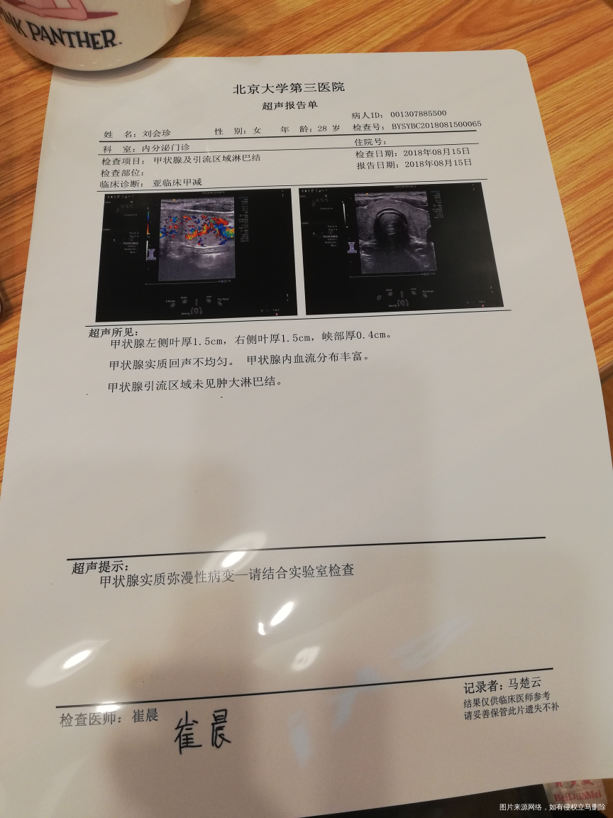 多囊查甲状腺查出这个结果