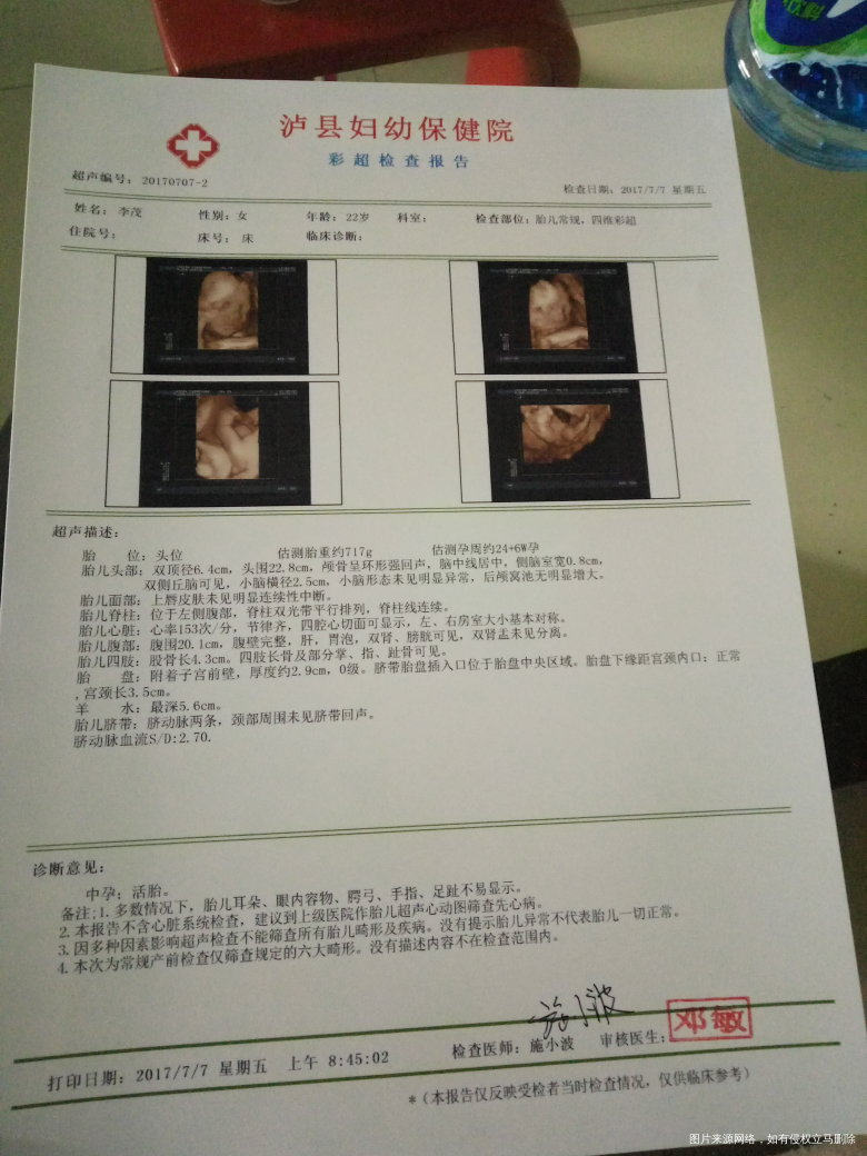 请问医生四维彩超侧脑室宽0.8厘米严重吗