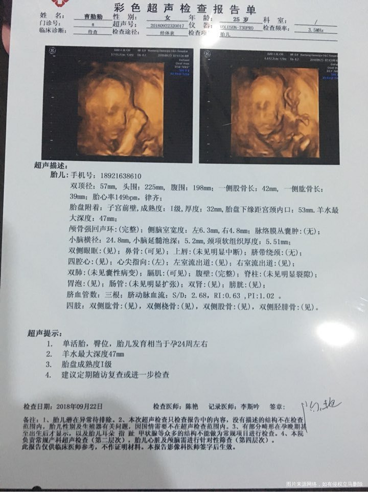 在备孕的道路上开出荆棘之花