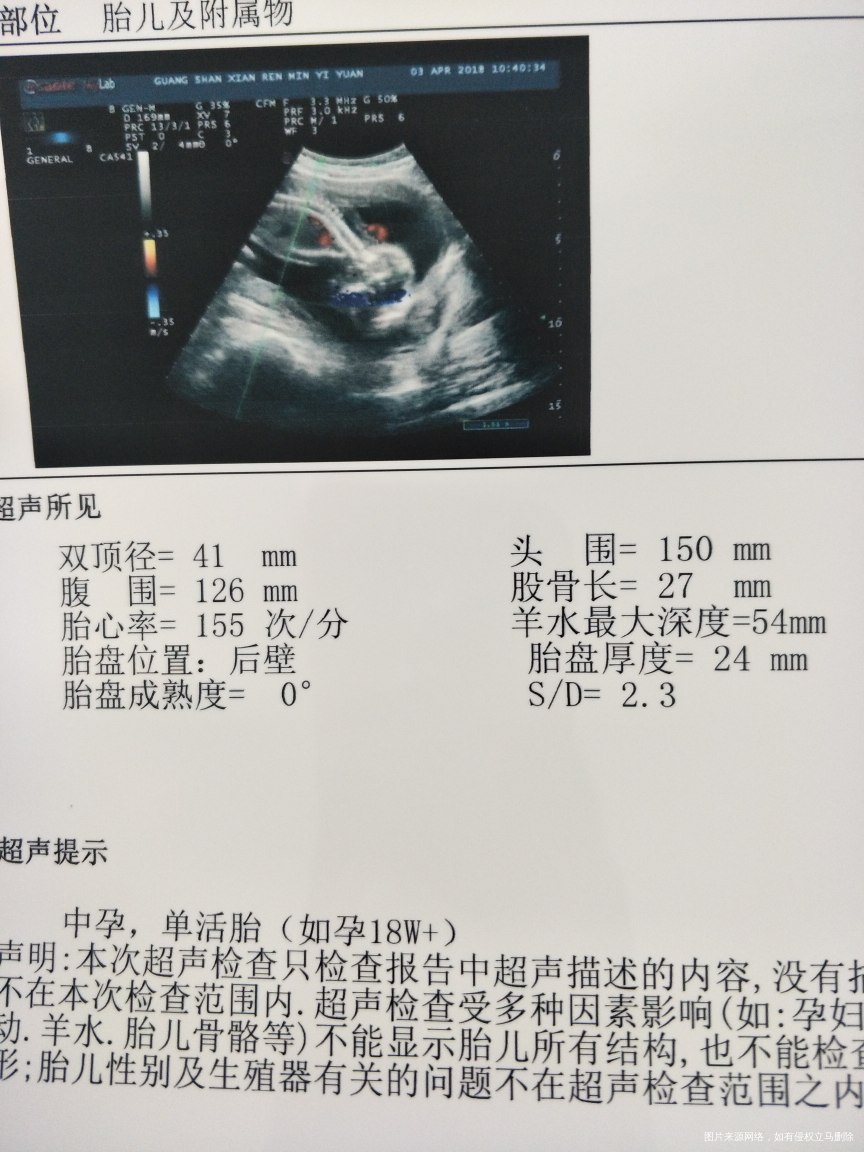 孕十八周的b超检查结果
