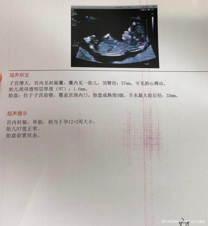 胎盘前置什么意思呀,求助