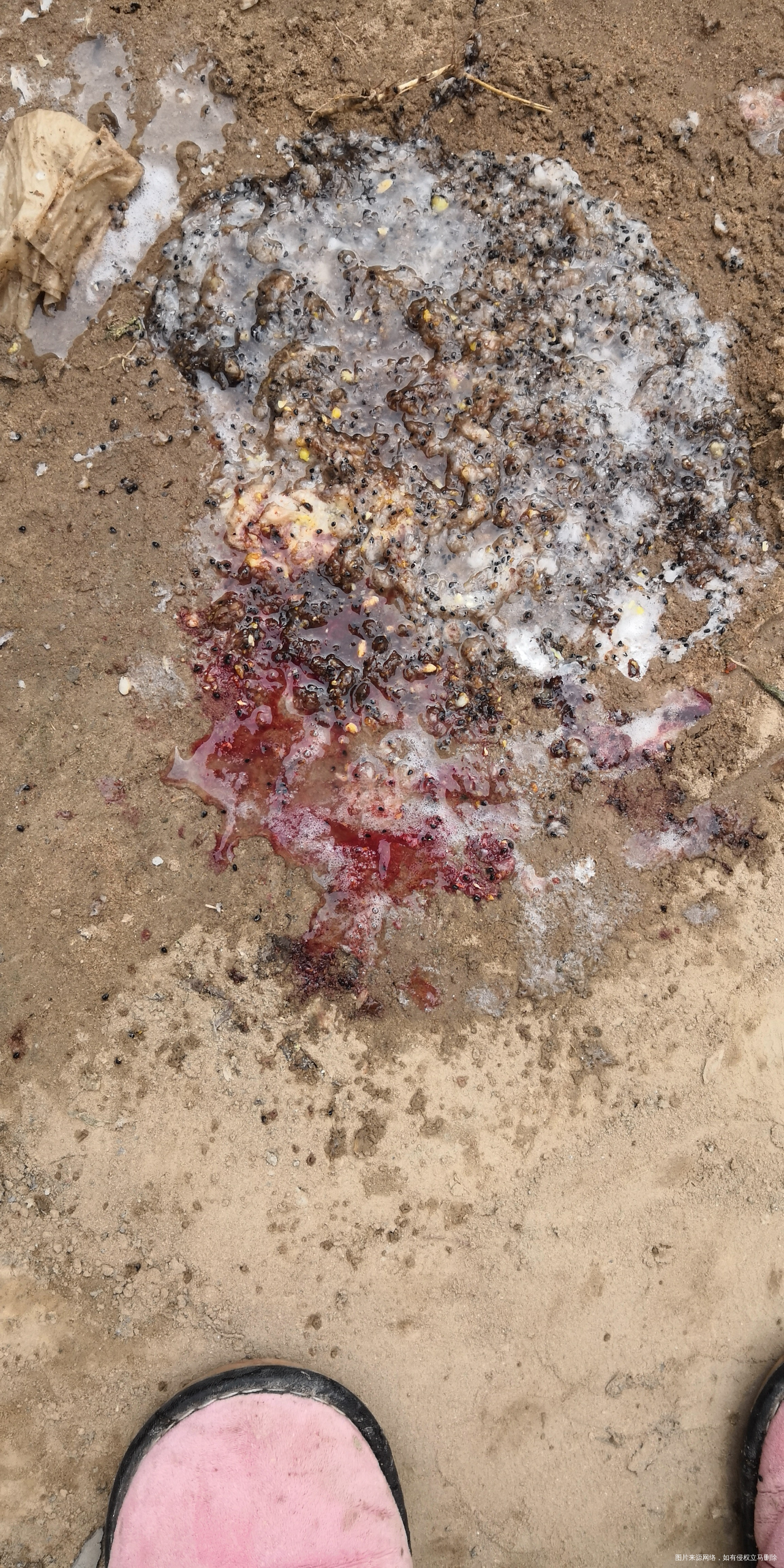 孕吐严重,吐血了怎么办?