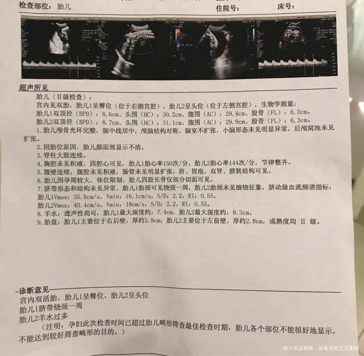 麻烦医生帮忙看看胎儿多少周了,多重?