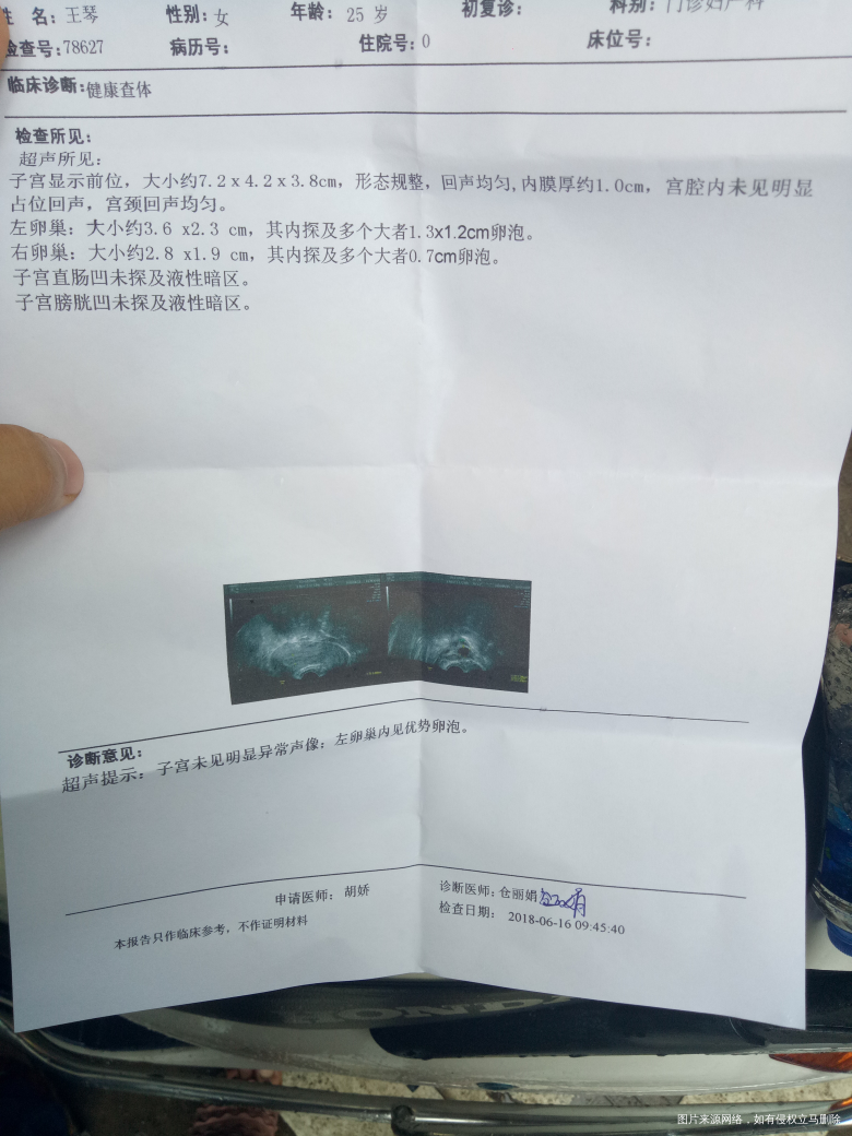 多囊卵巢促排,月经第15天