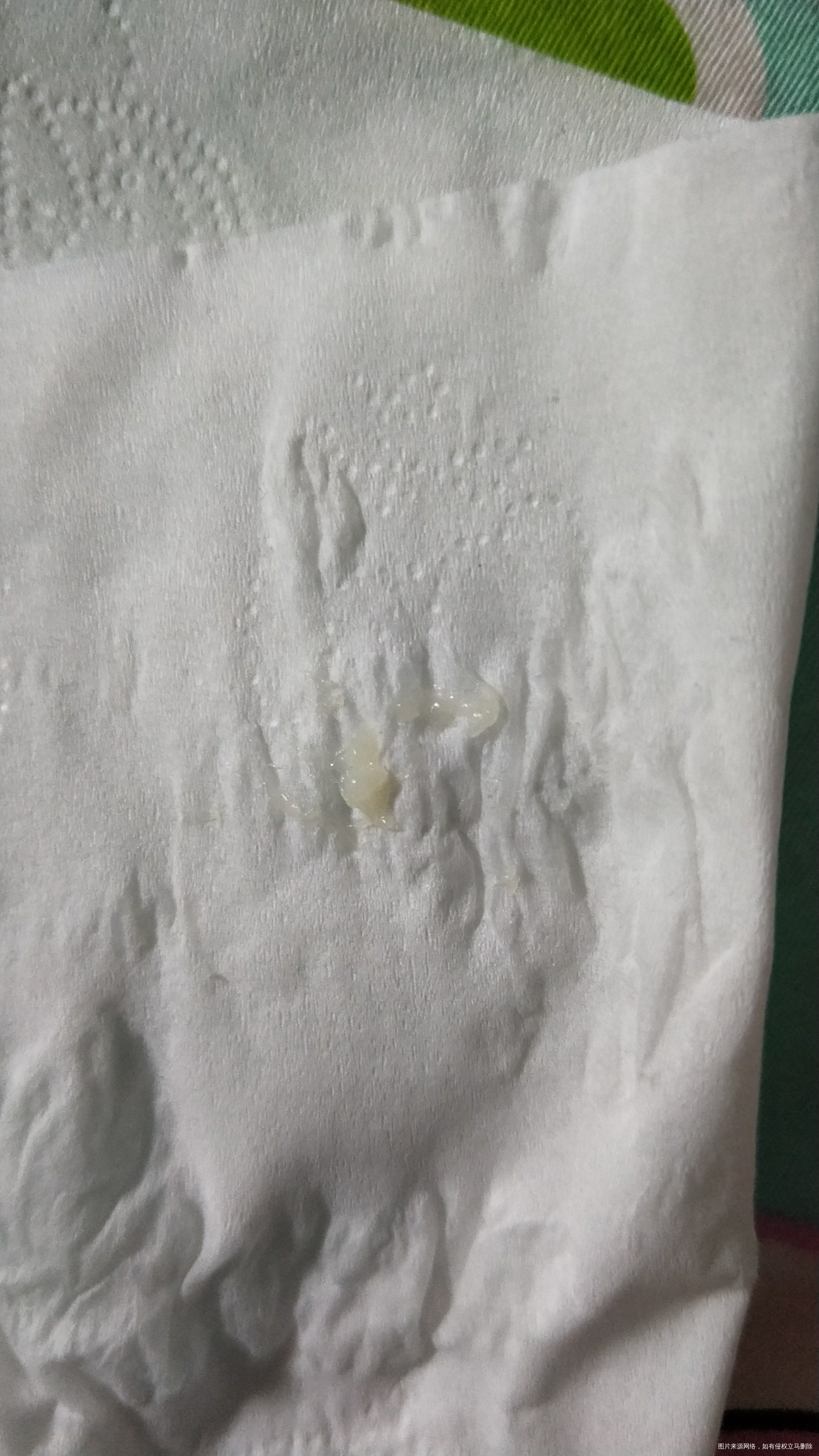 这个到底怎么了给我看一下谢谢阴道里排出来的应该23号来月经