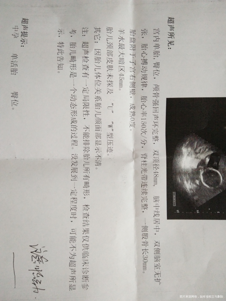 怀孕20周加3,帮我看看小孩发育的怎么样?