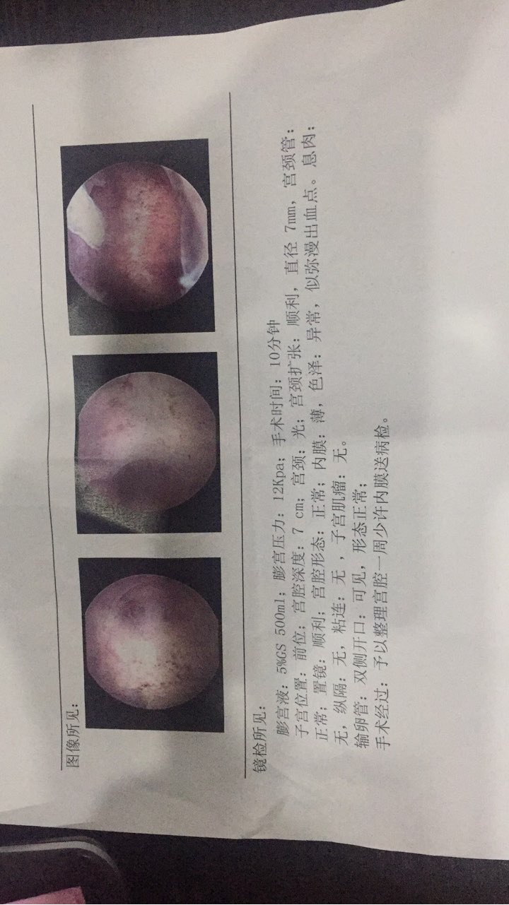 今天做了宫腔镜检查内膜不太好