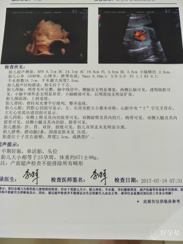 帮忙看看四维数据是不是正常