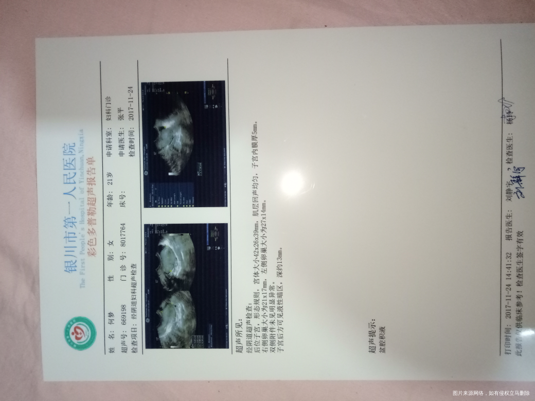 今天去医院检查有盆腔积液