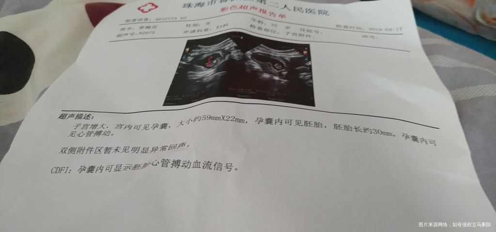 孕十周B超,胎儿大小正常吗?