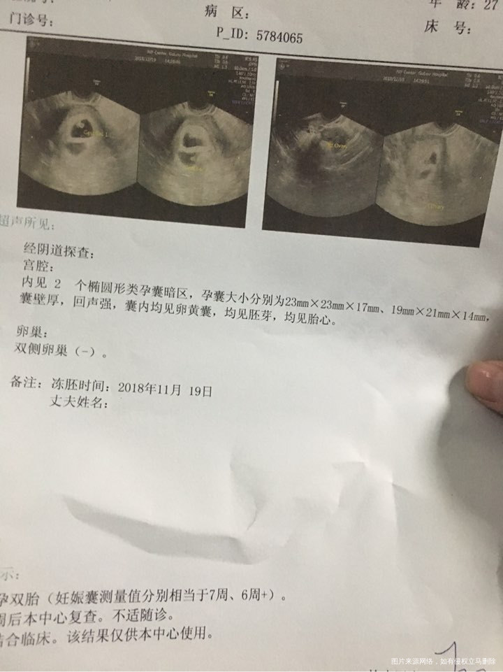 一超顺利通过,医生看了我就说我脸色不好,让我去查个血常规,哎天天孕吐吃不下,脸色好就怪了