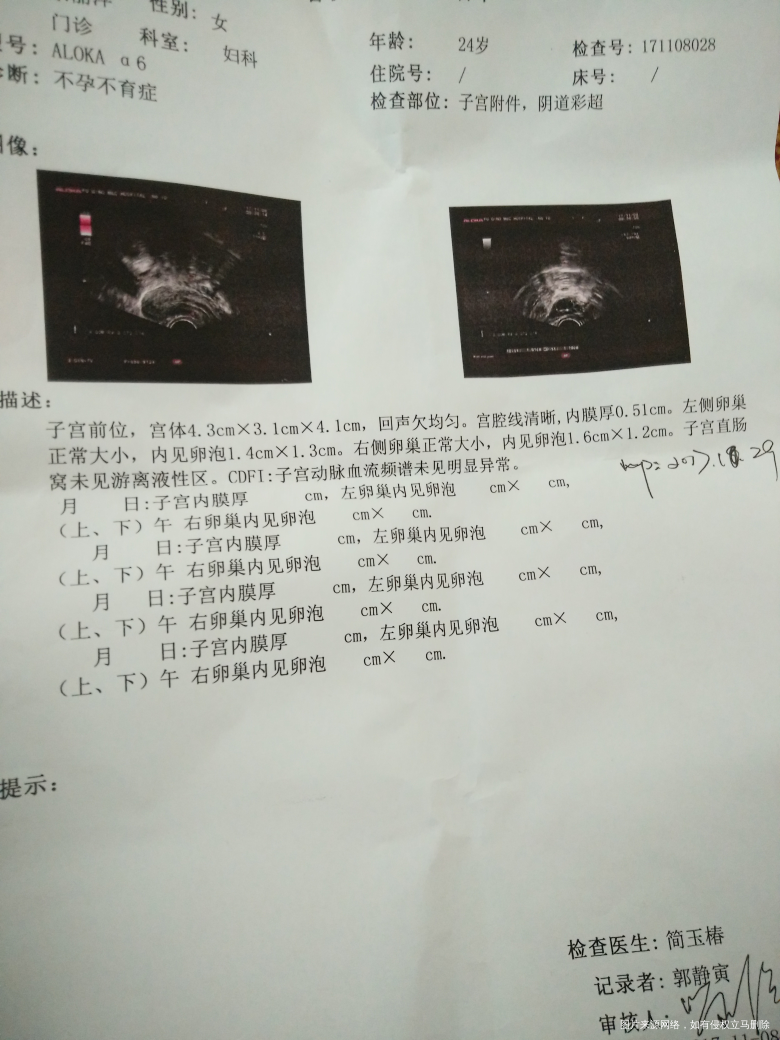 促排卵,这个月有促排的姐妹吗?