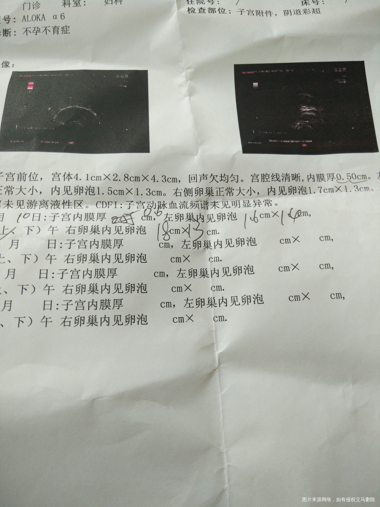 促排卵月经第十四天。麻烦医生给点建议