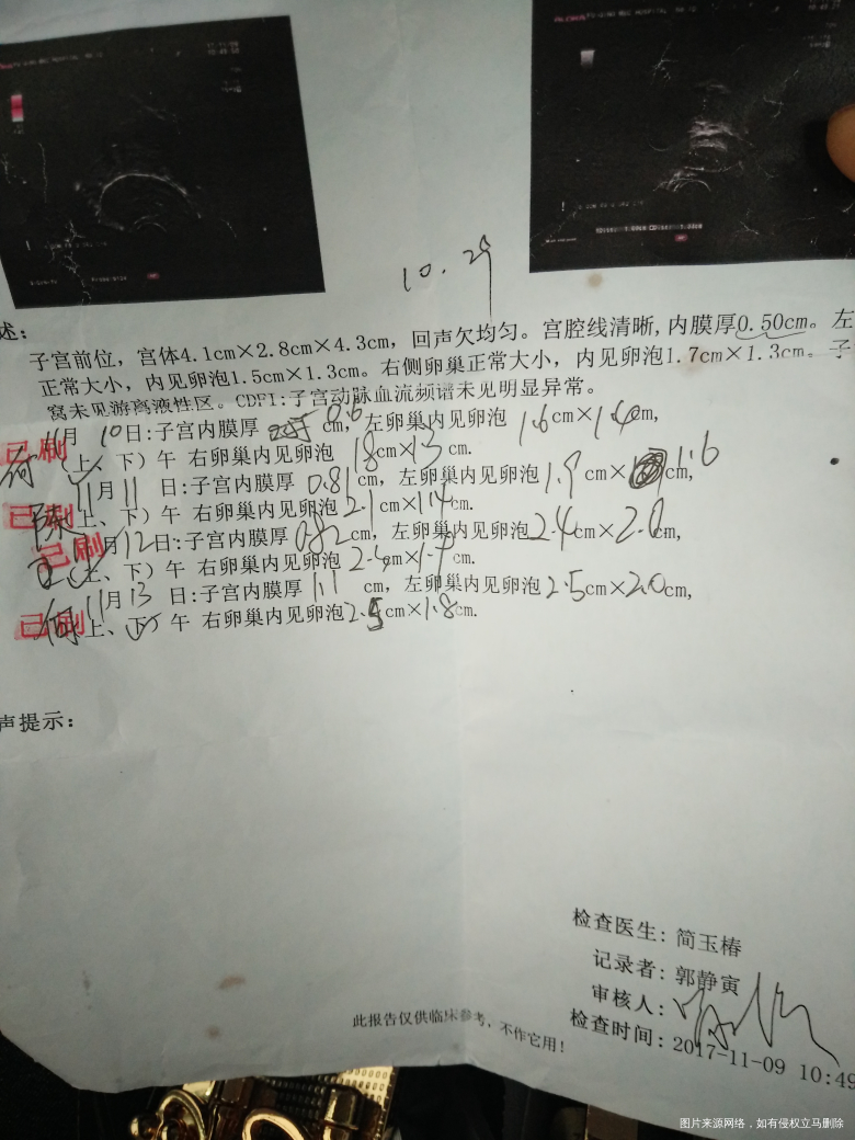 多囊促排,医生说没用了我该怎么办