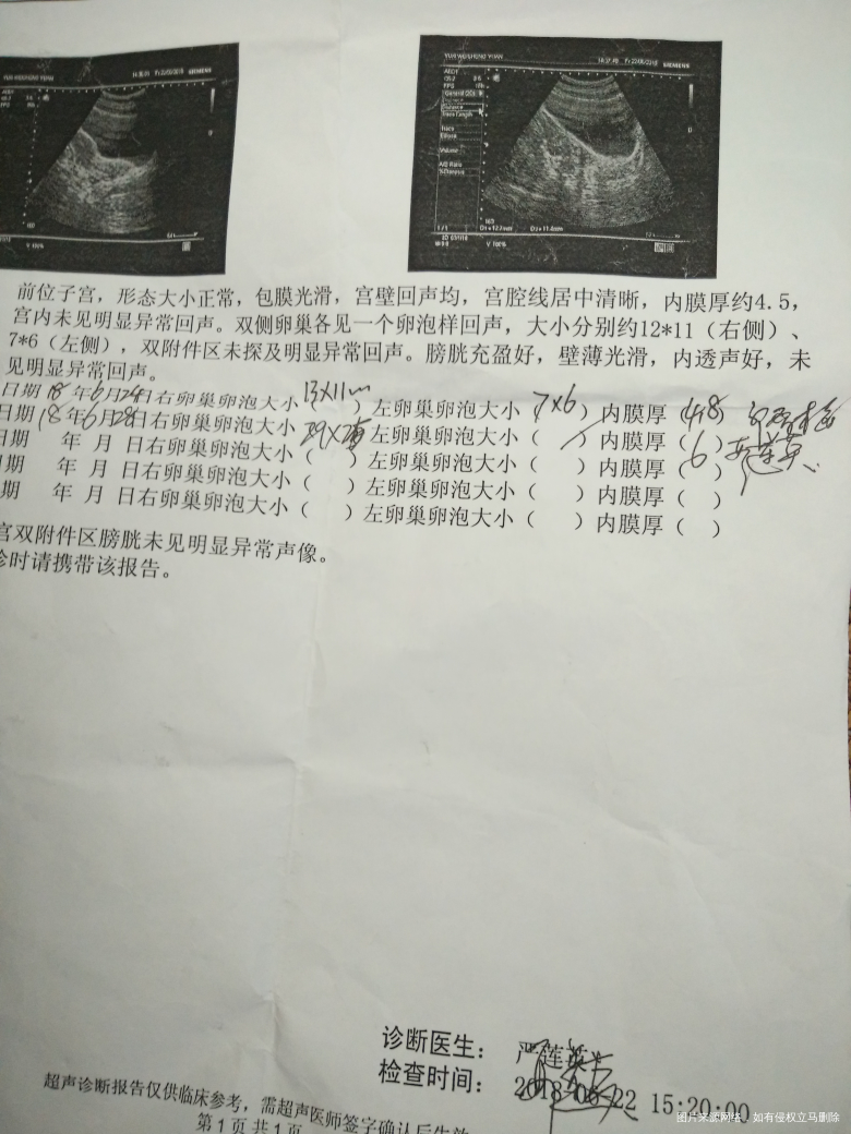 真是郁闷死啦,浪费钱也浪费时间。