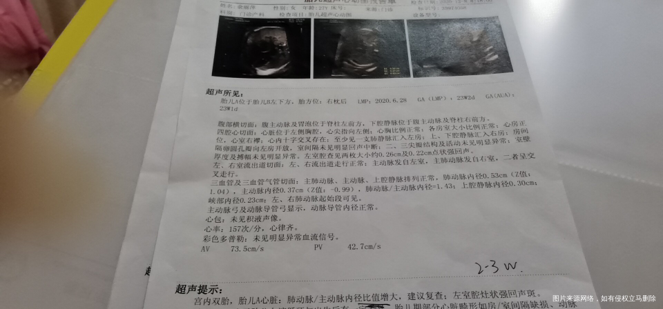 四维彩超和心动图有点问题。有一样情况的吗?