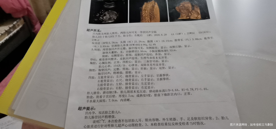 四维彩超和心动图有点问题。有一样情况的吗?