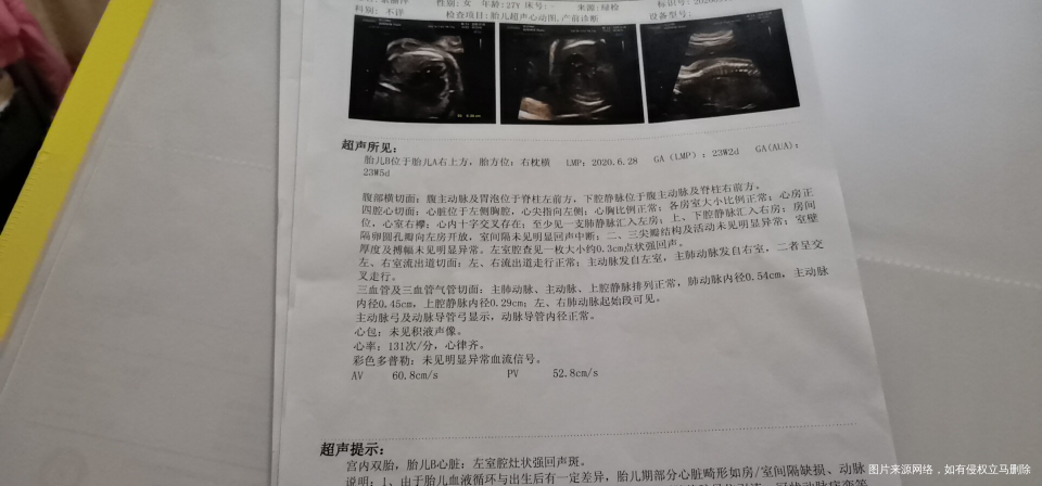 四维彩超和心动图有点问题。有一样情况的吗?