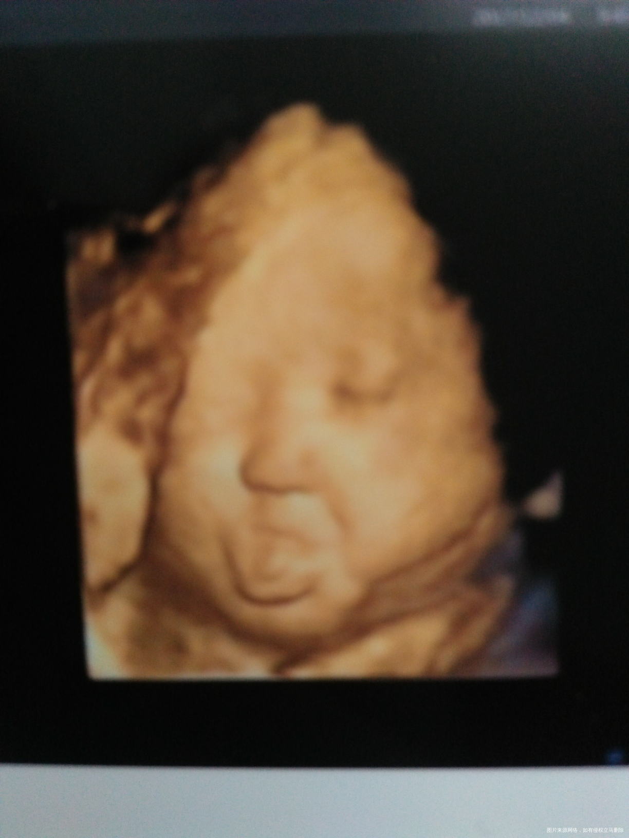 
今天照四维,拍到崽崽吐舌头的照片,给姐妹们分享下,虽然其他部位不是很清晰,但我…