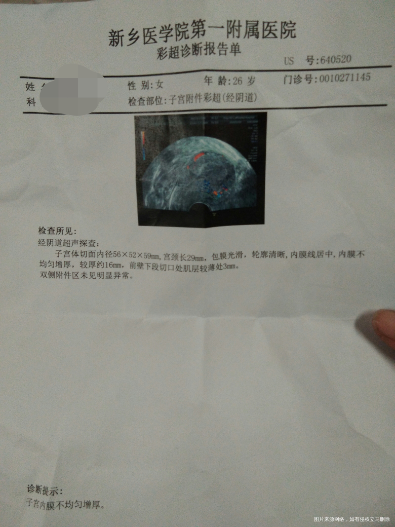 子宫内膜厚薄不匀请医生帮忙看看怎么治疗