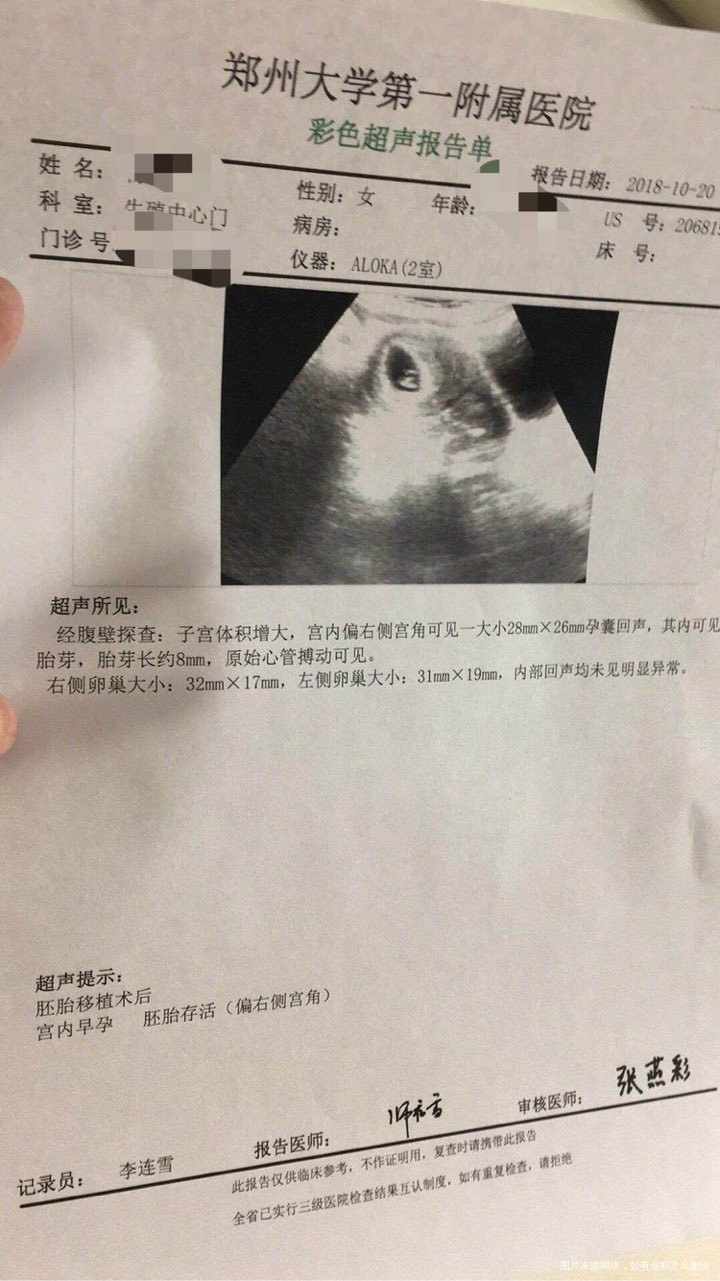 我怀啦 | 怀孕了，但是偏右侧宫角处妊娠