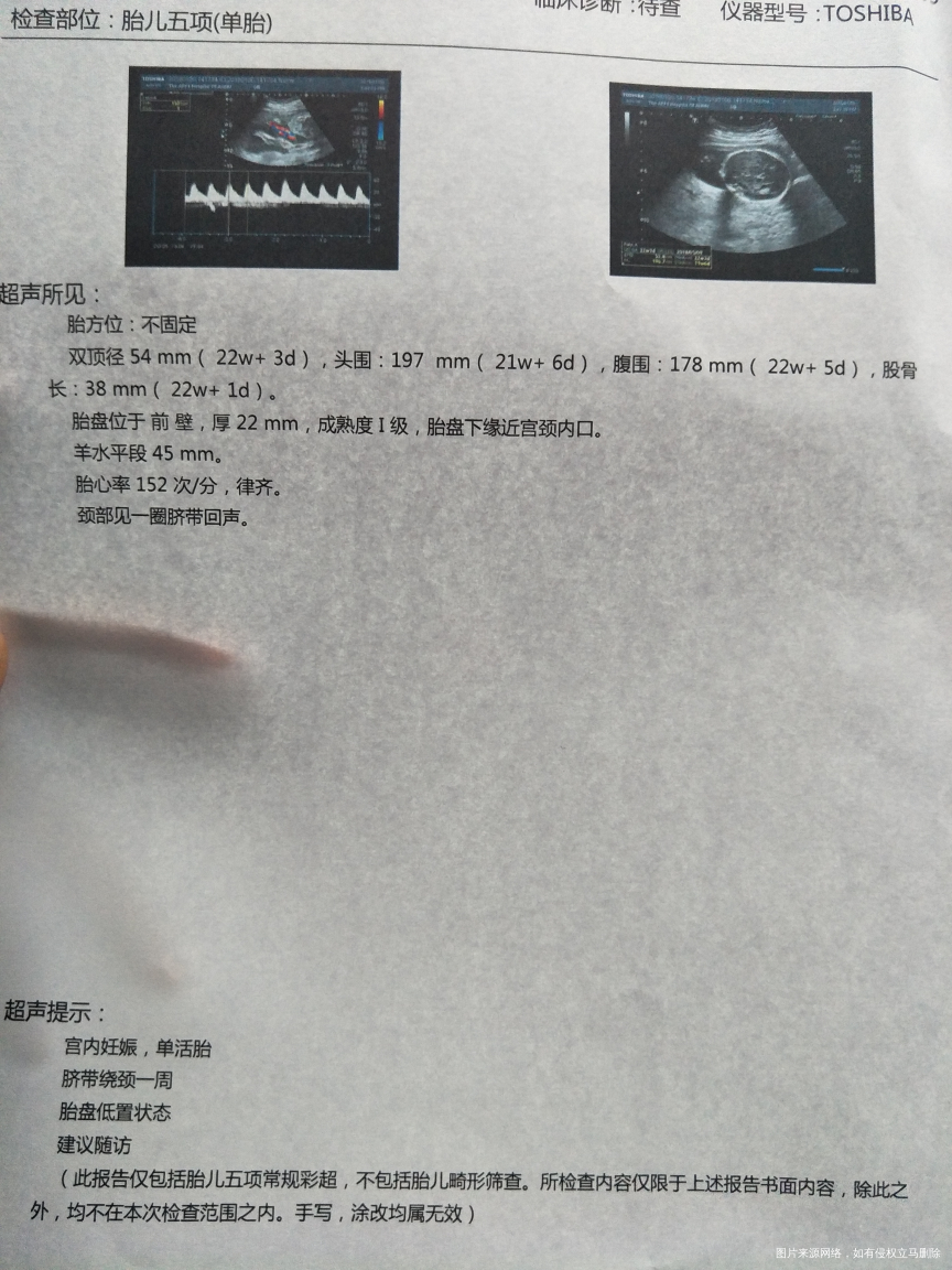 拜托医生帮我看看胎盘低置