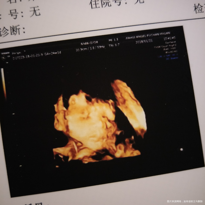 四维归来,宝贝你要加油!!