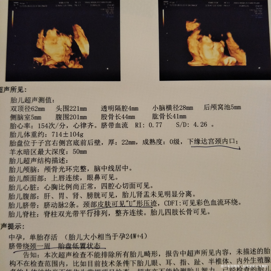 四维归来,宝贝你要加油!!