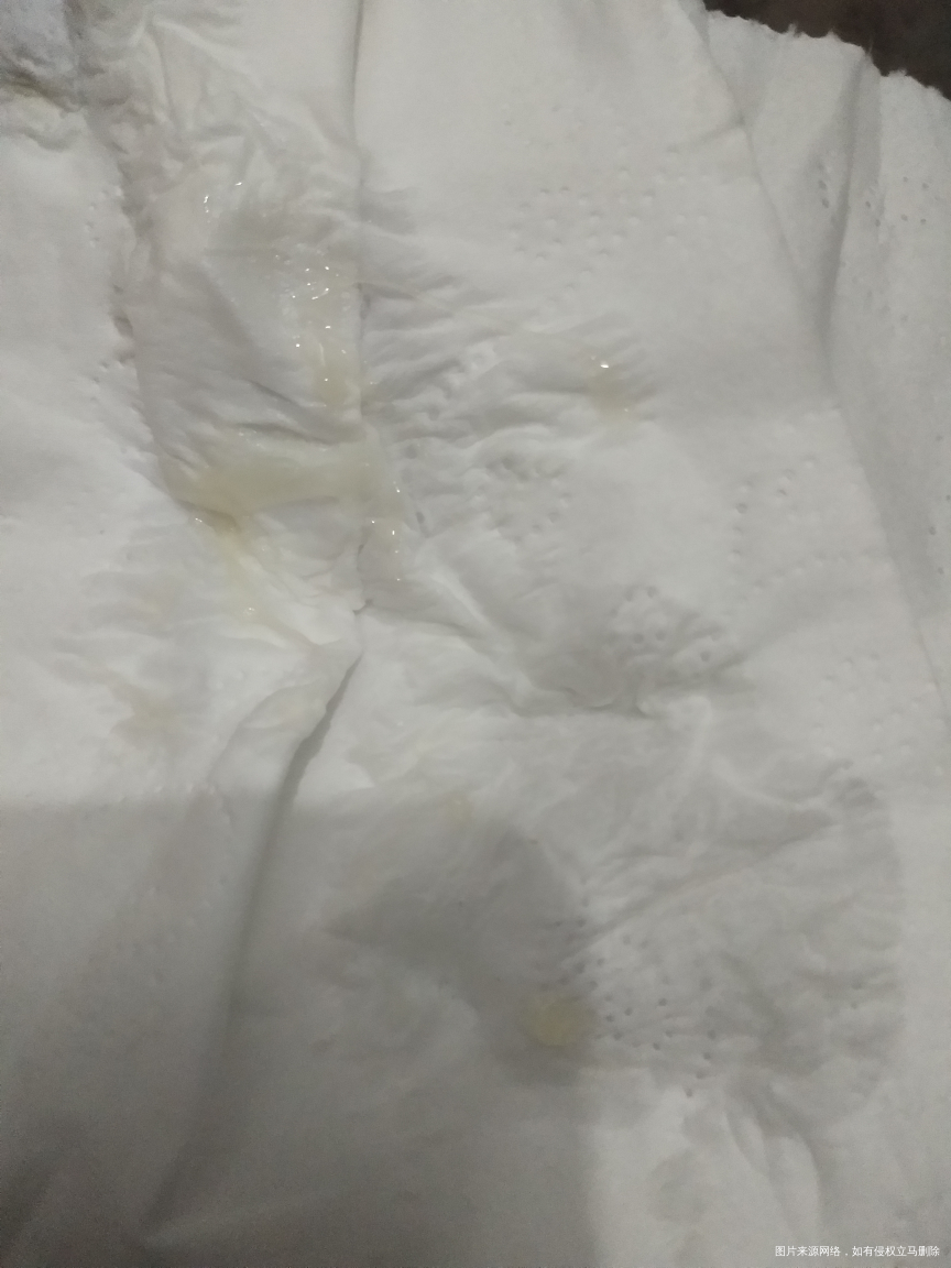 第一次发,帮忙看下是不是排卵了