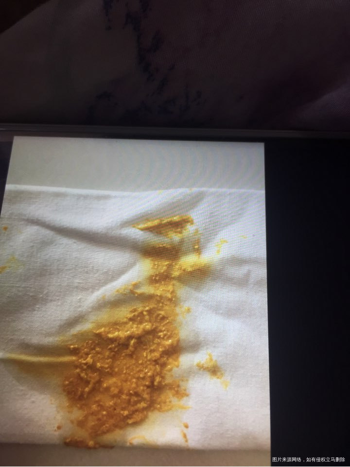 请问医生十一天的新生儿母乳喂养拉出来的便便是否正常?