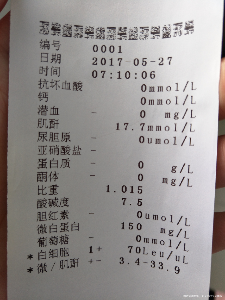 亲们我做的尿常规帮我看看正常吗?