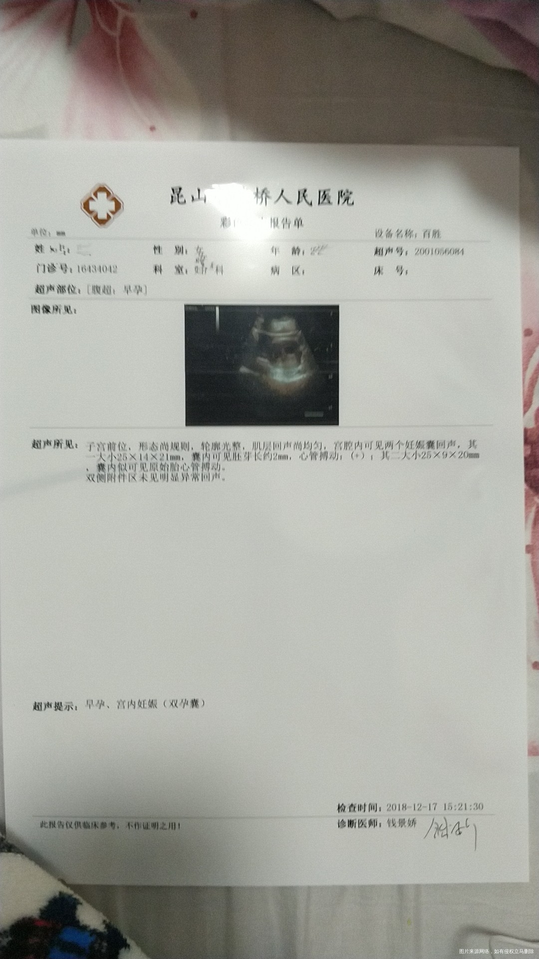 看看这是双胞胎么啊嗯