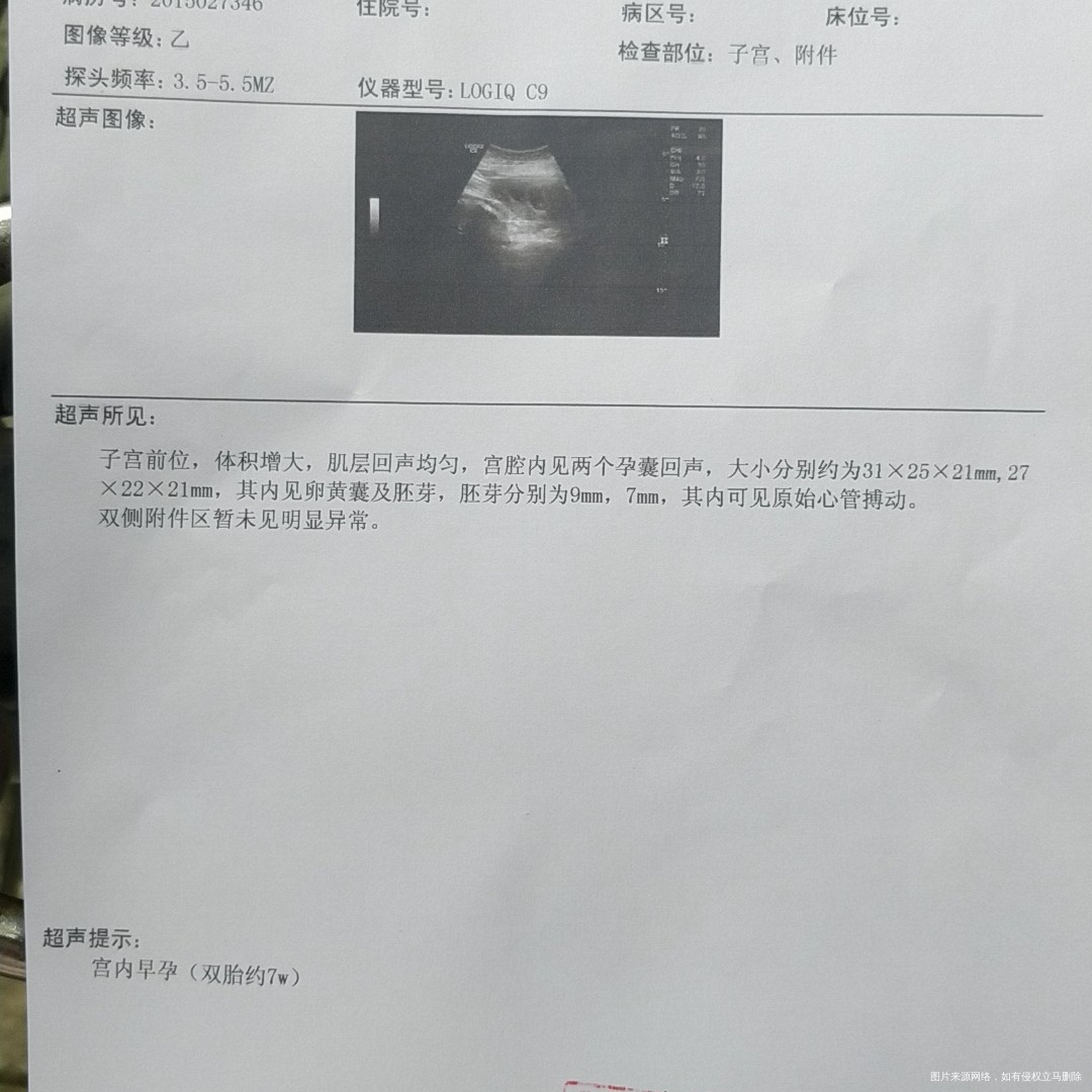 姐妹们看看看看复查结果