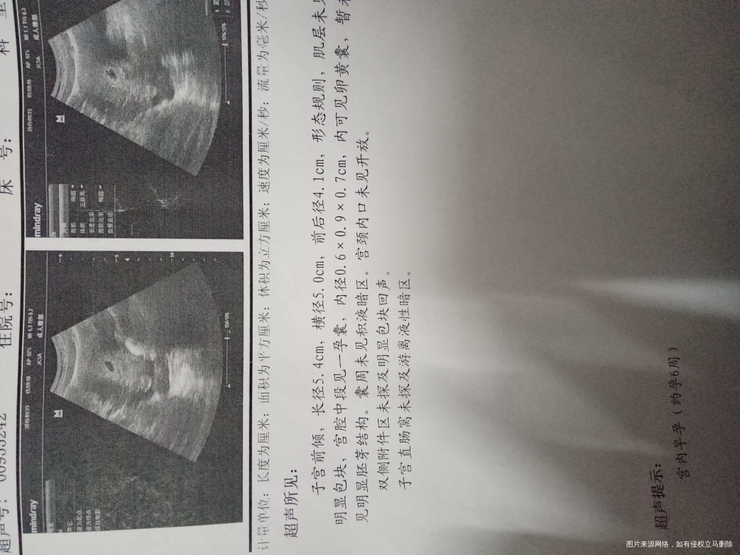 十月怀胎的点滴的历程